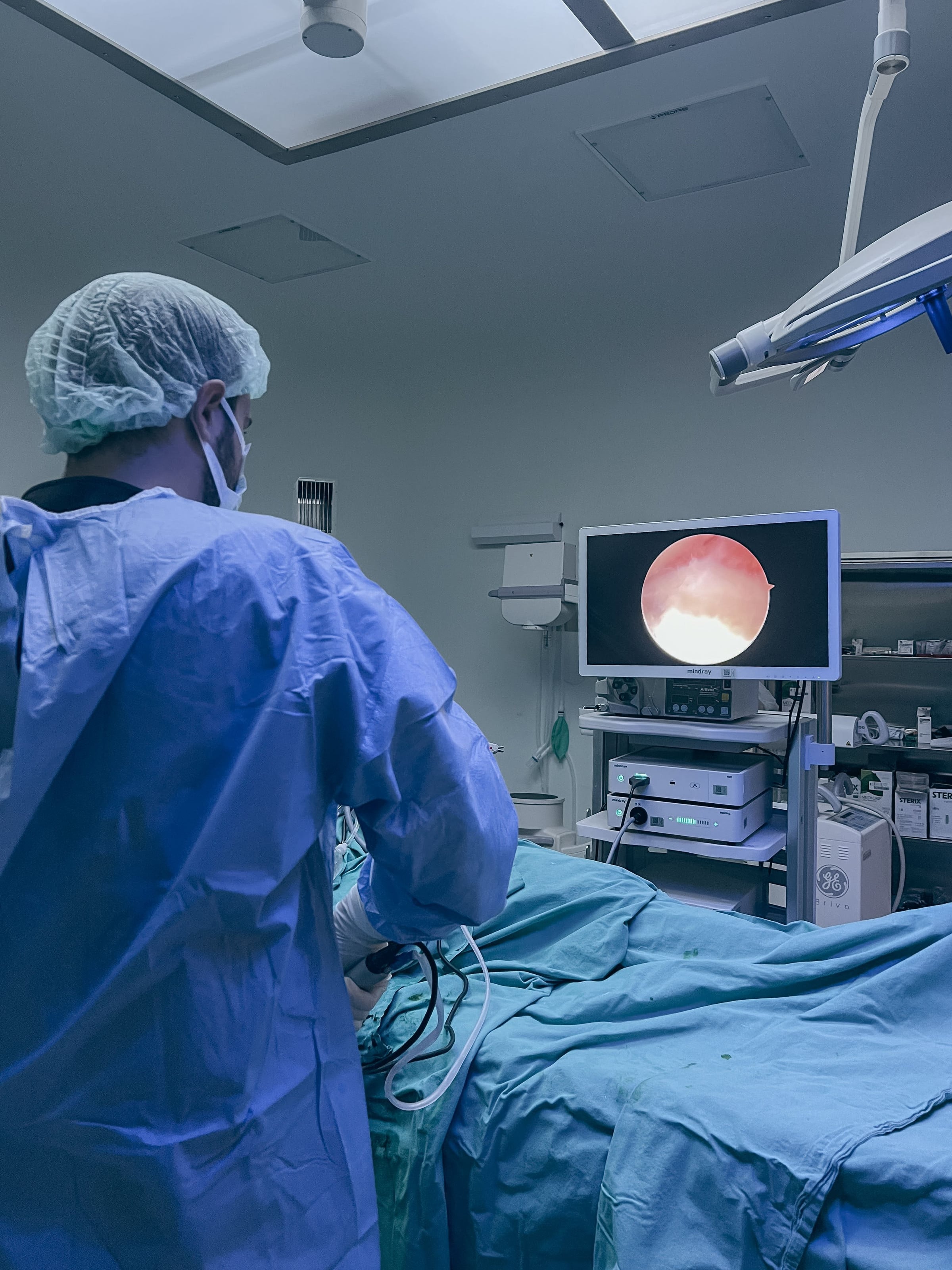 Equipo médico realizando una endoscopia con el monitor a la vista